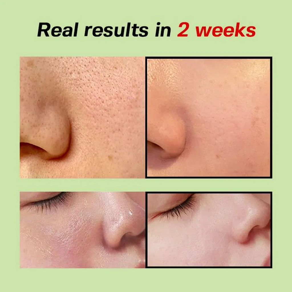 Green Tomato Pore Lifting Ampoule
