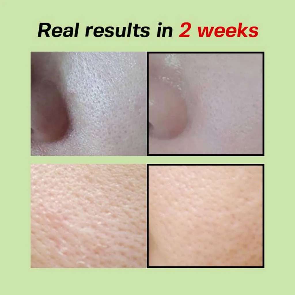 Green Tomato Pore Lifting Ampoule