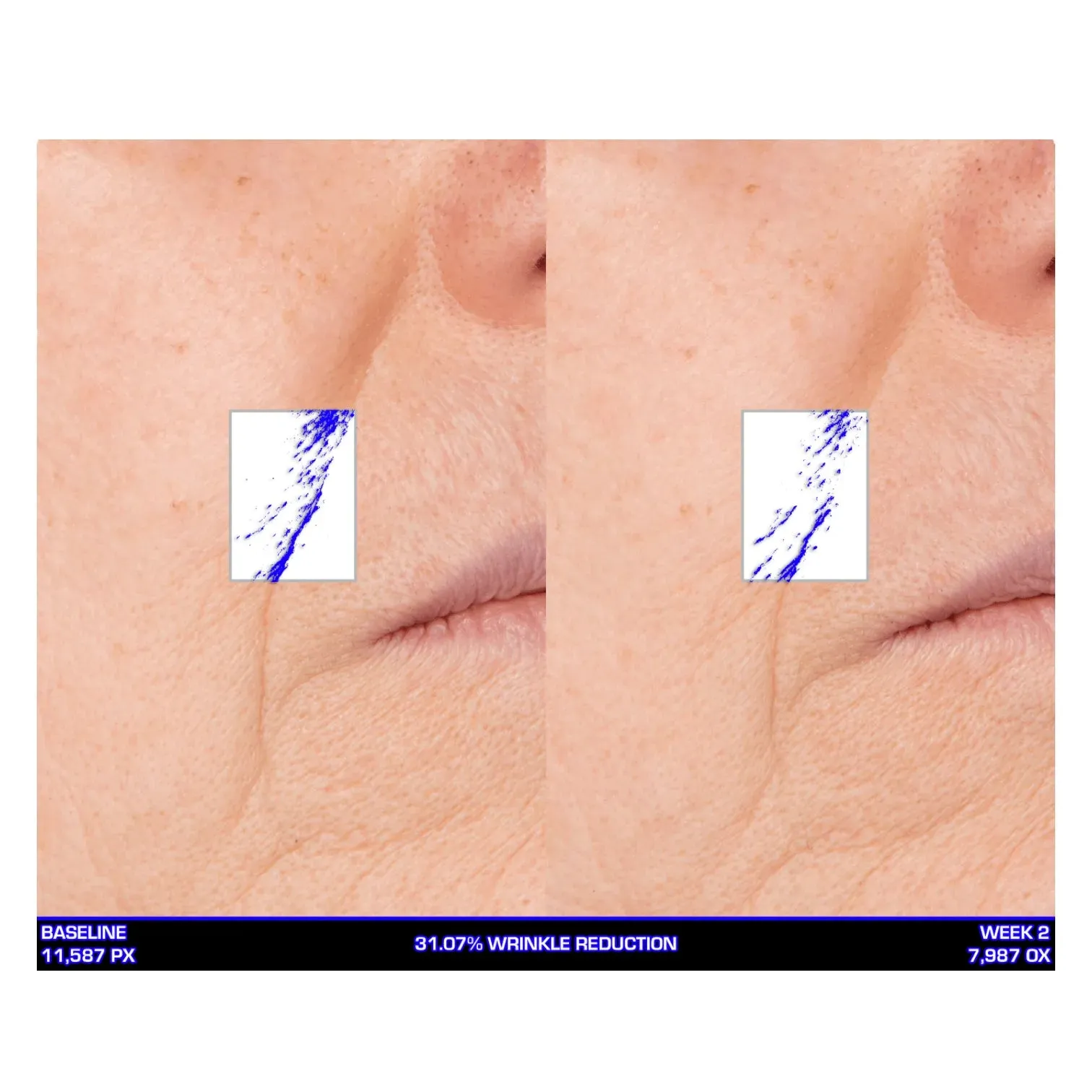 Ultra-Mare Serum