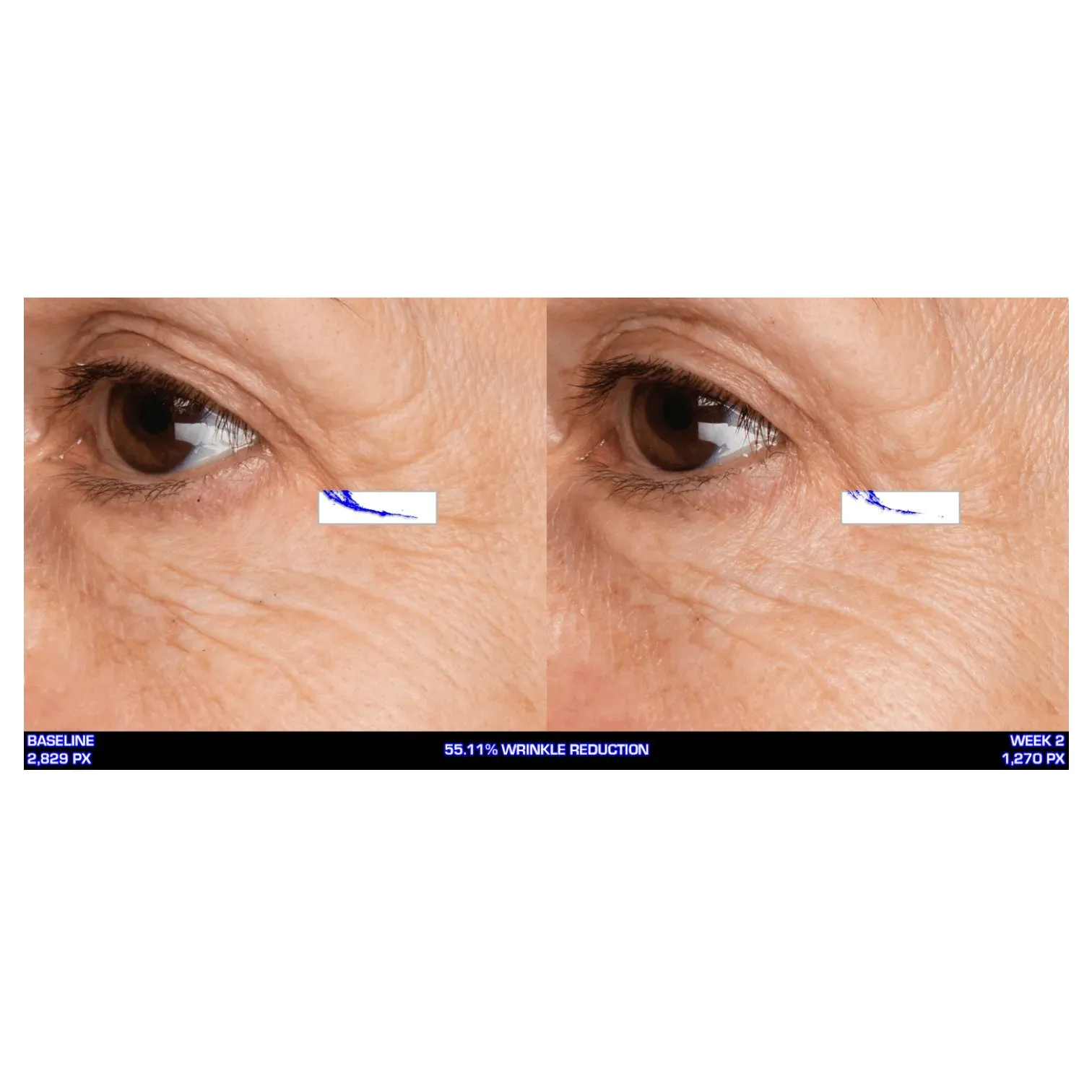 Ultra-Mare Serum